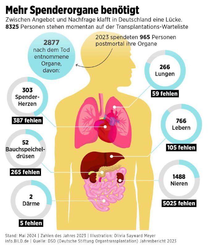 Deutschland plant automatische Organspende nach dem Tod